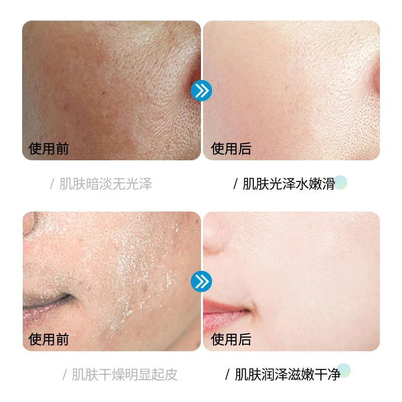 150ml