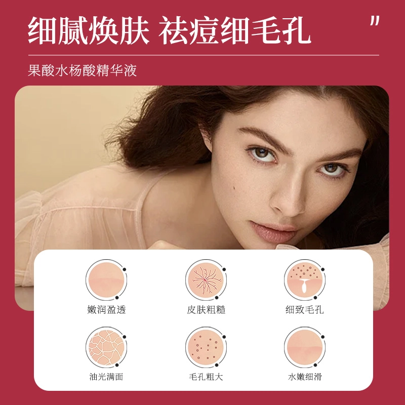 臻羞 果酸水杨酸精华液 保湿收缩毛孔滋润祛痘祛粉刺紧致毛孔