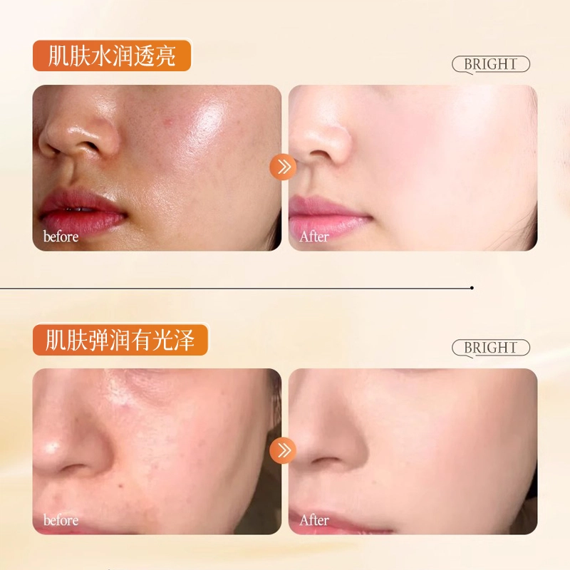 C25ml*5