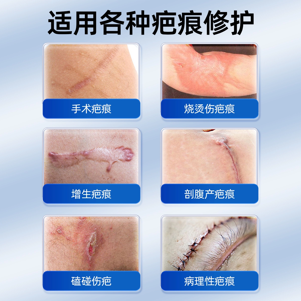 仁和 医用硅酮  印疤痕膏 舒缓