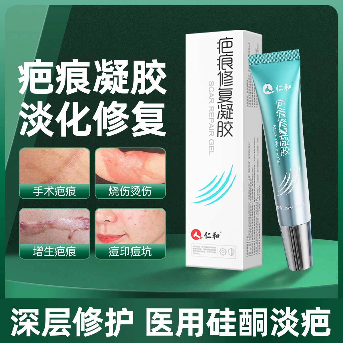 仁和 医用硅酮  印疤痕膏 舒缓
