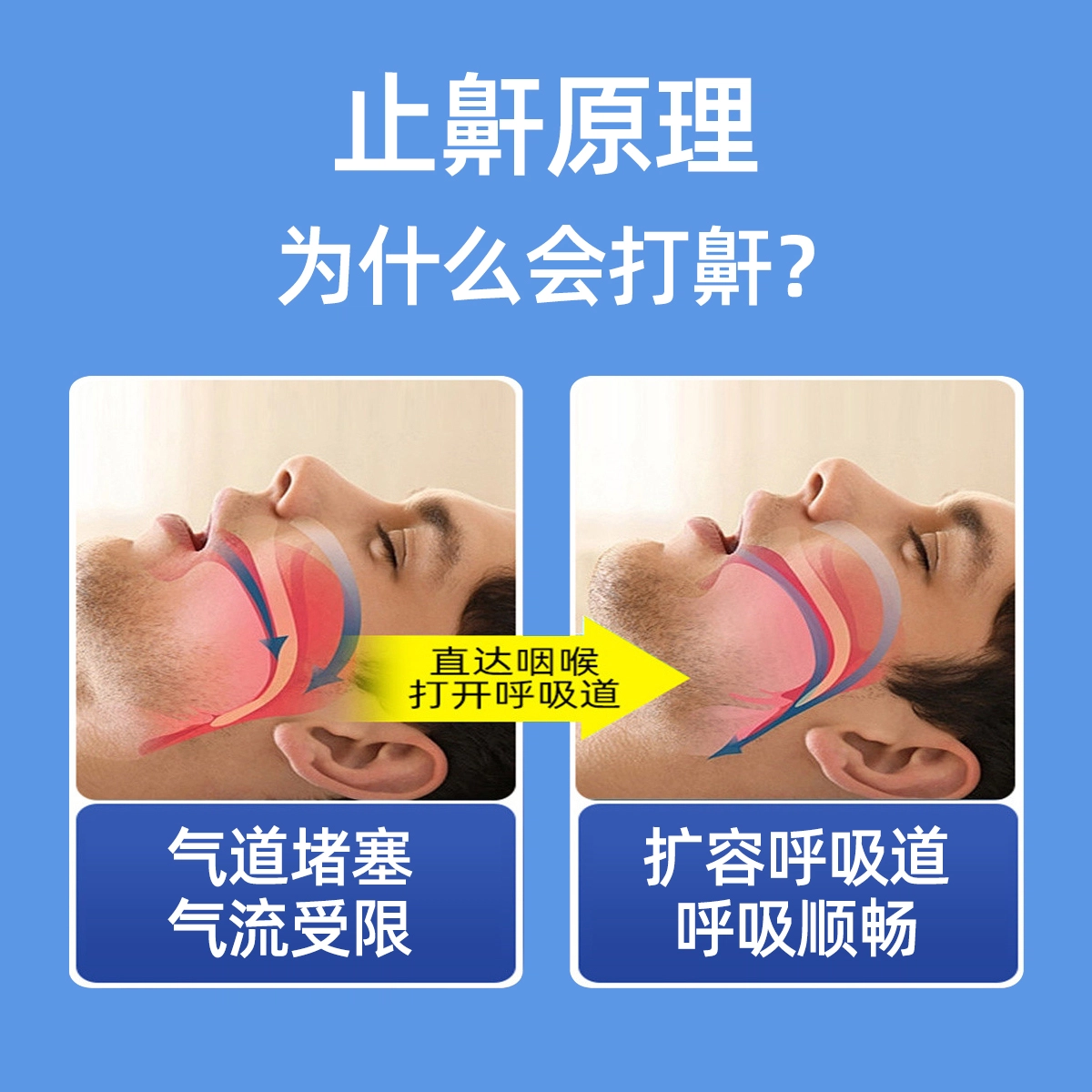20ml