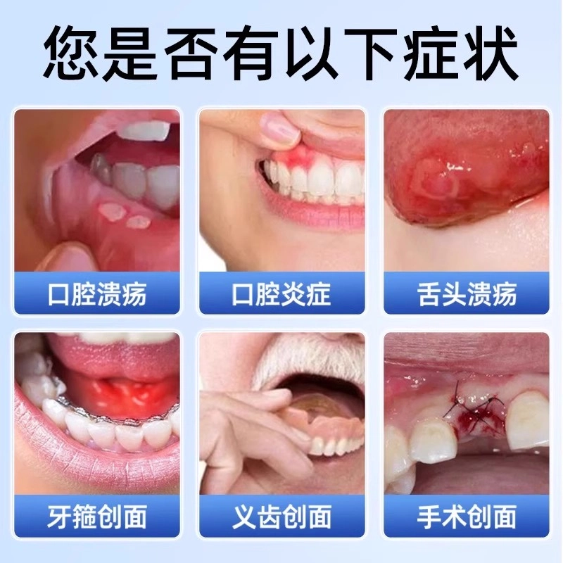 仁和 医用缓解口腔炎症含漱液清新口气牙周护理