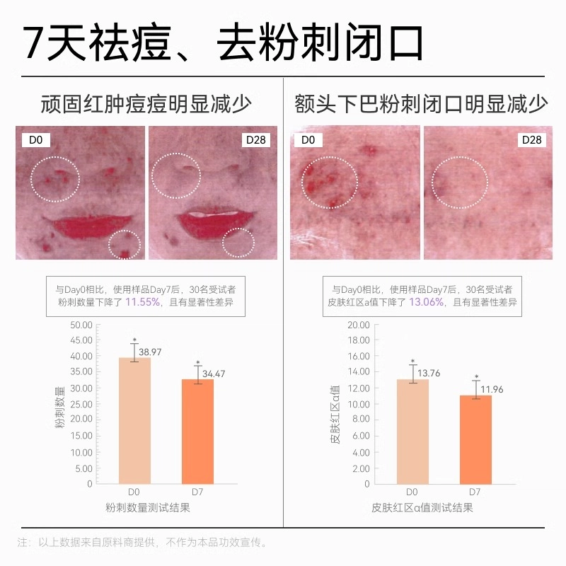 哈恩 德国 女士果酸洁面护肤套装 紧致滋润去角质清洁祛痘