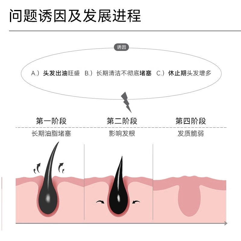 哈恩 咖啡女士洗头露洗发水 护发控油去头屑柔顺