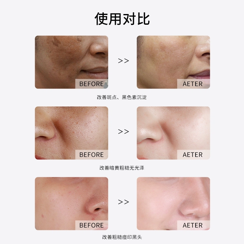 100ml+100ml