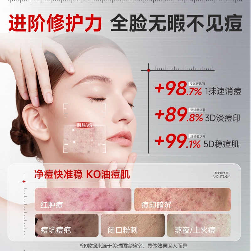 美瑞图果酸焕肤去闭口精华液 控油收缩毛孔淡痘印