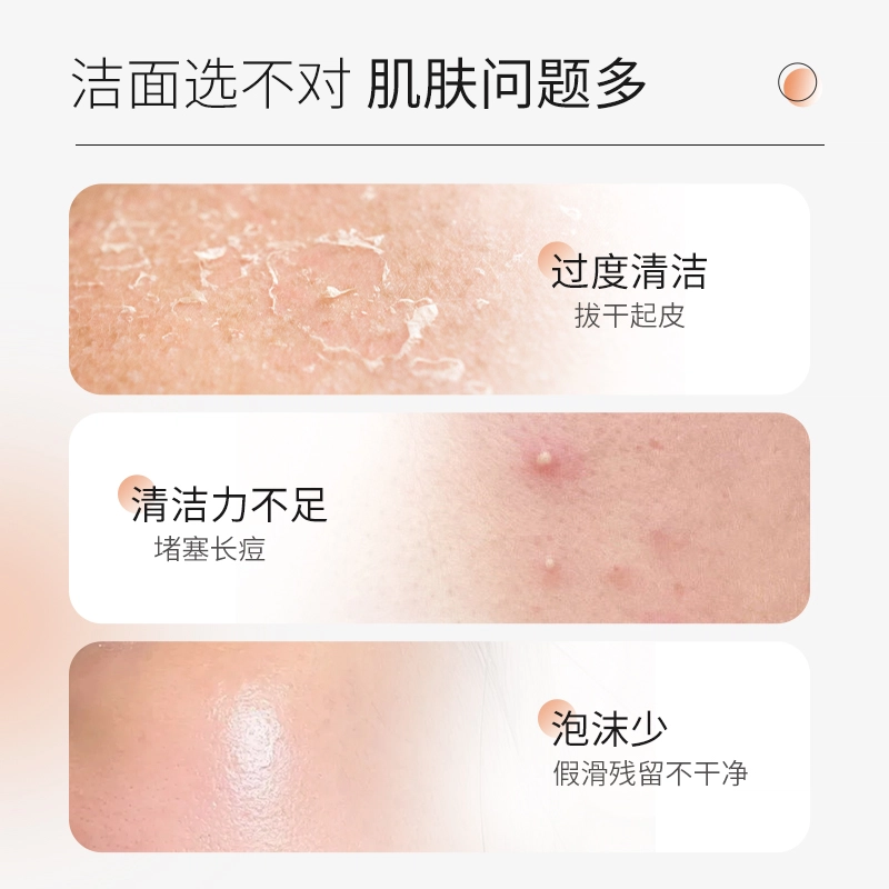 特一 美白淡斑洁面乳提亮肤色淡斑抗氧化 去黑头闭口控油清洁  淡痘印
