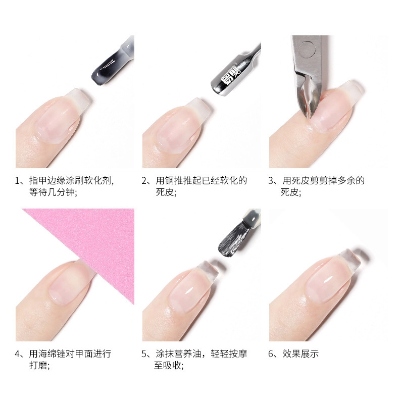 恩妮诗  死皮软化剂护理营养油套装 去角质防倒刺修手指边缘护理美甲营养油