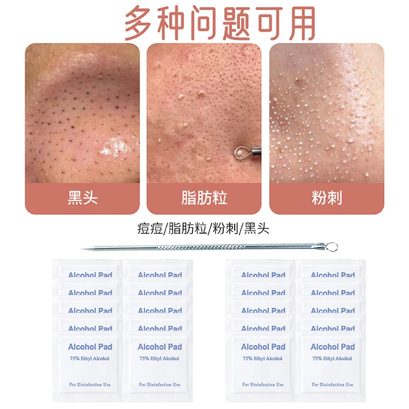 娇雪菲  超尖超细粉刺针闭口针刮黑头清暗疮针单支祛痘专用工具挑痘痘神器
