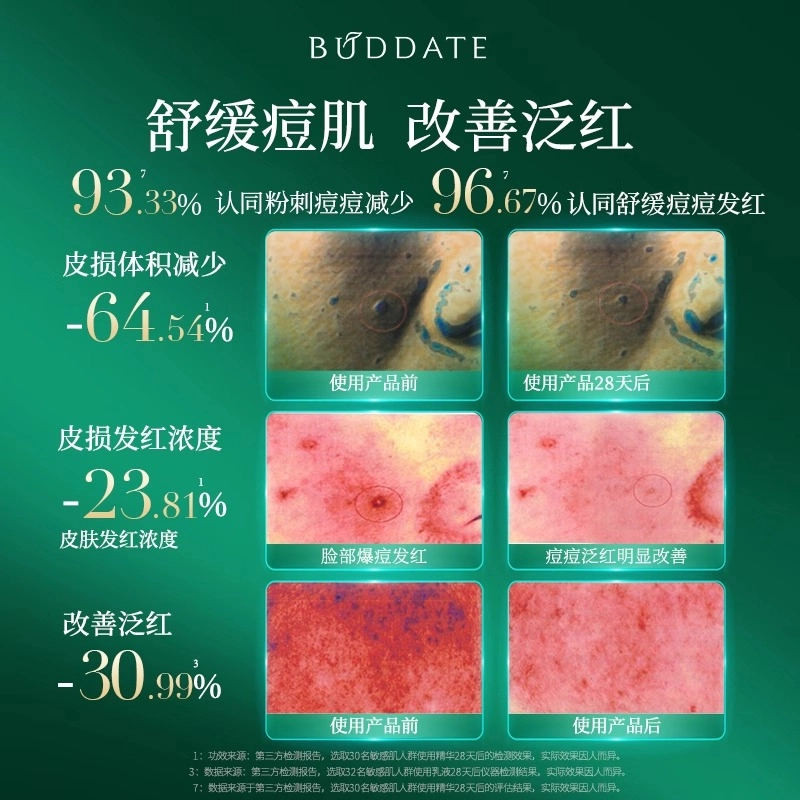 发芽时光 敏感肌改善泛红水霜组合 舒缓保湿修护 修复
