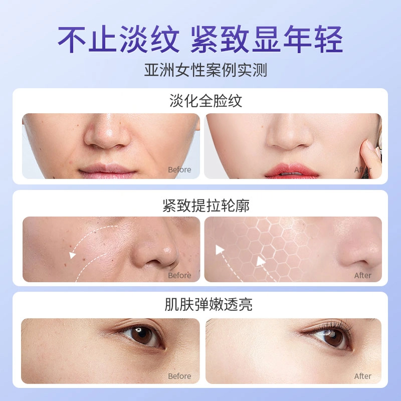 5*28ml