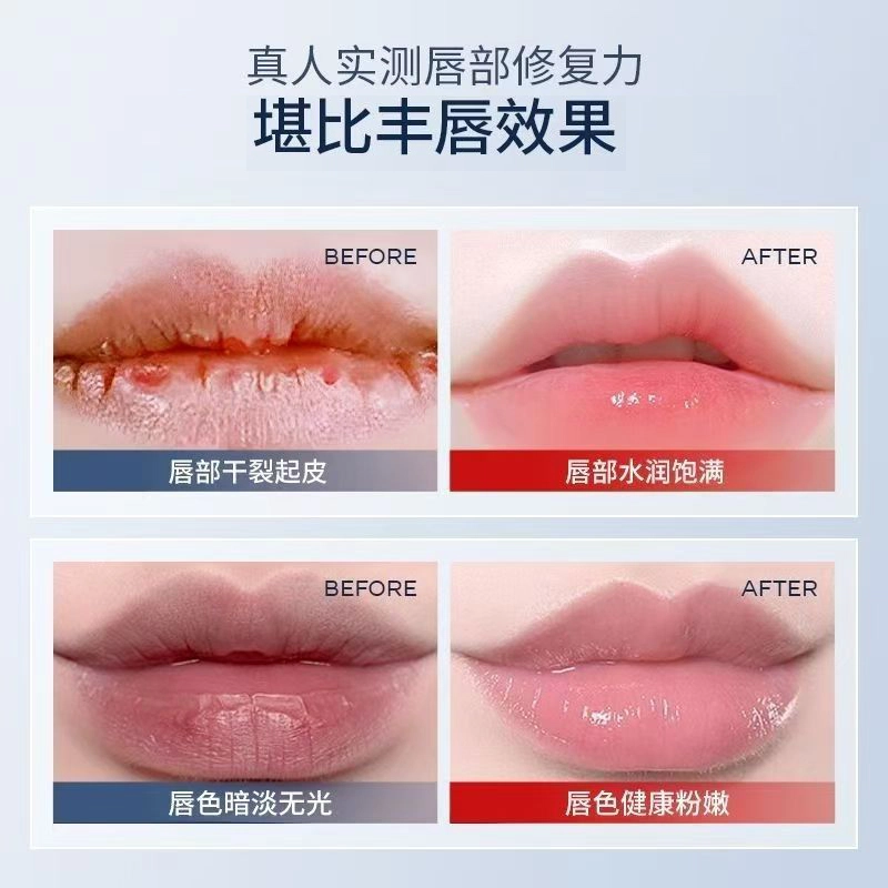 10ml