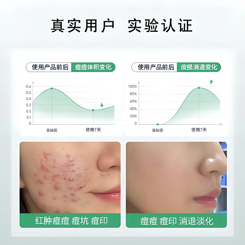 25ml*10