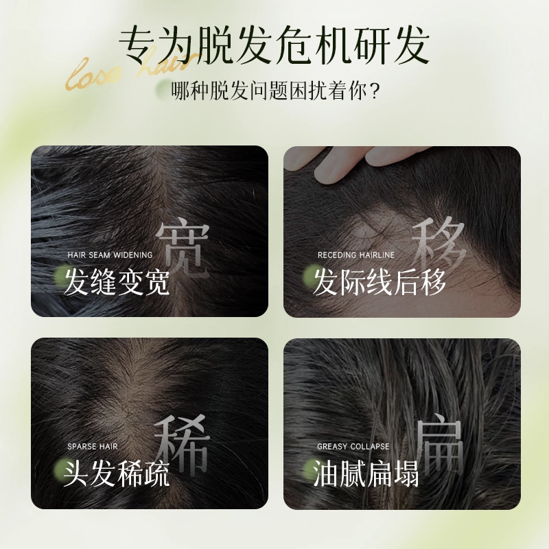 仁和匠心 防脱控油洗发水 深层清洁去头屑固发