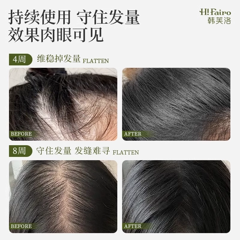 韩芙洛控油蓬松益生菌炫白亮泽洗护套装 深层清洁柔顺植物养护