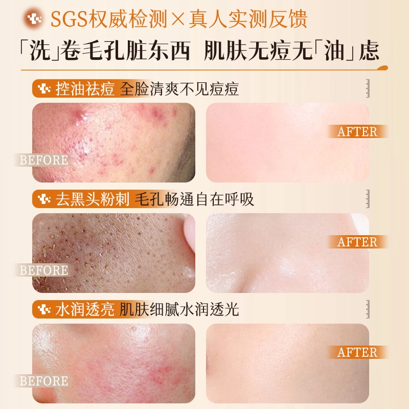 SDD 500g