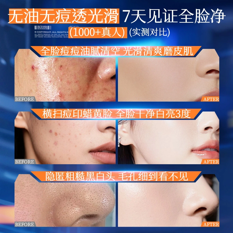 SDD B5 120ml