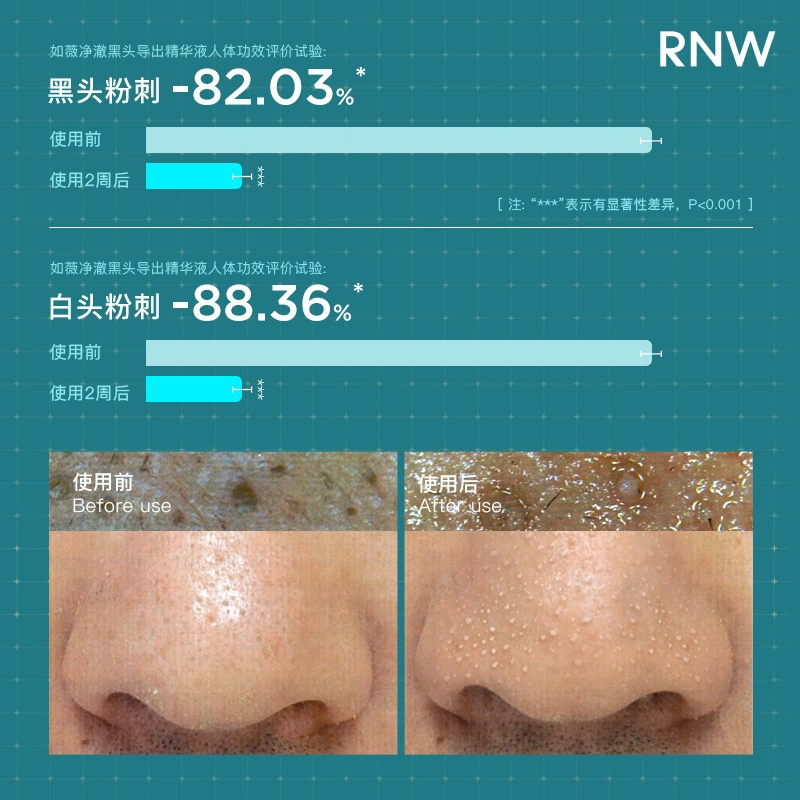 RNW100ml