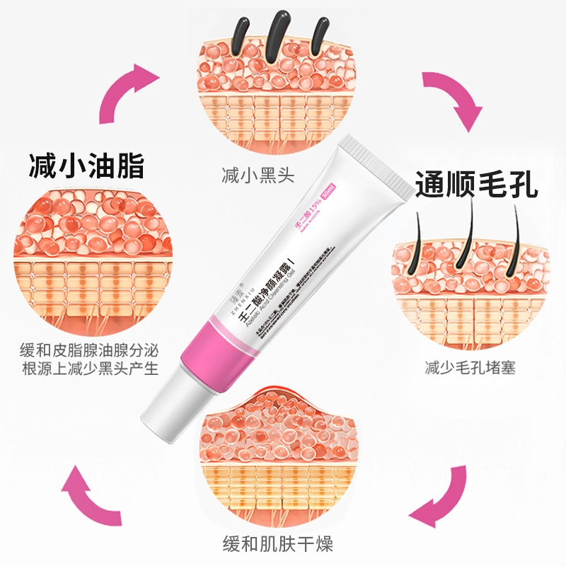 臻羞  壬二酸净颜凝露乳霜 膏状 修护 干皮混合肌中性肌