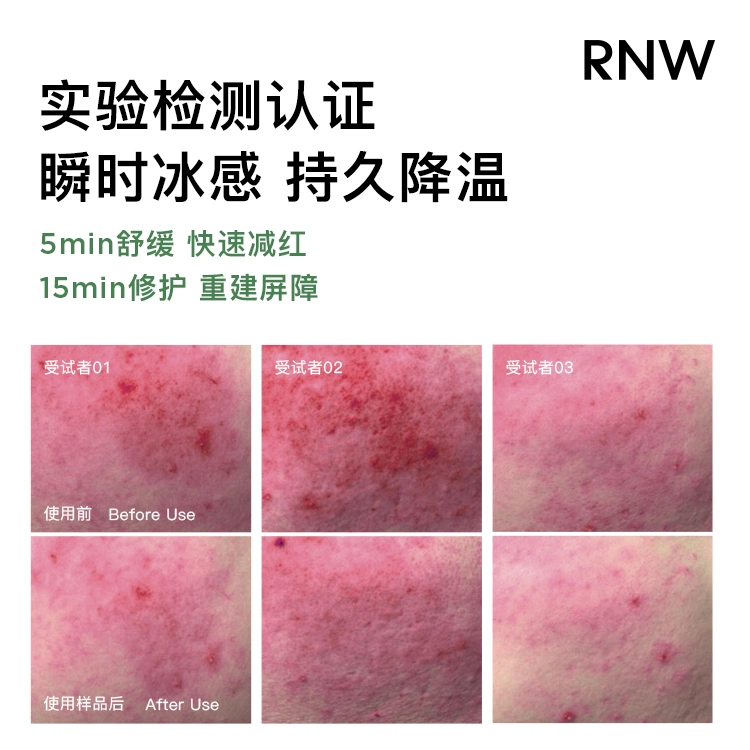 RNW