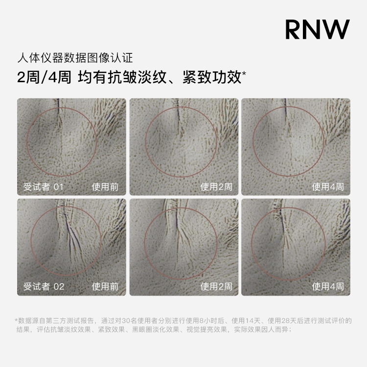 RNW 15ml