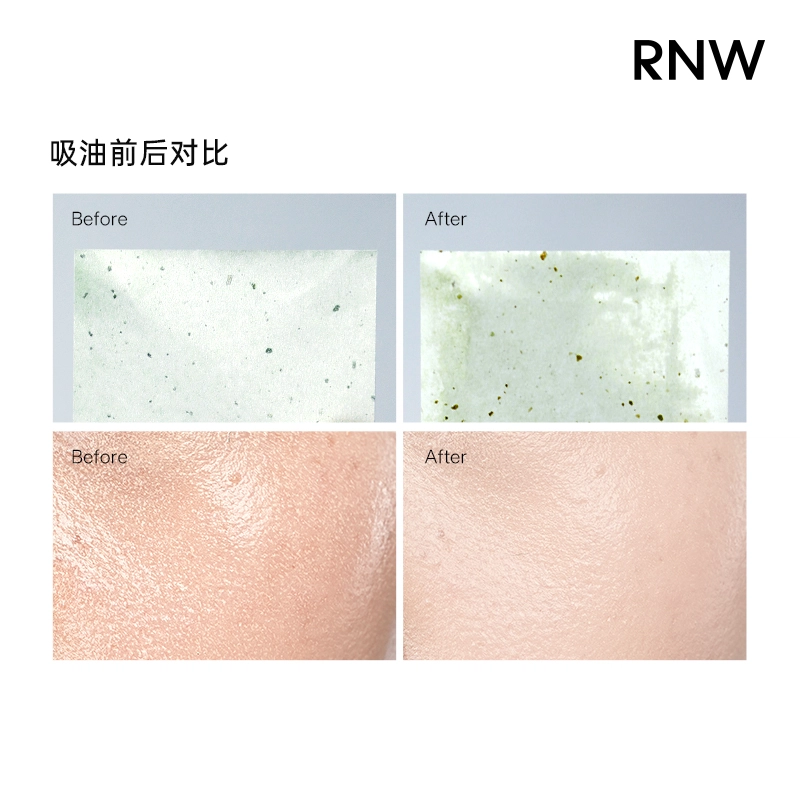 RNW
