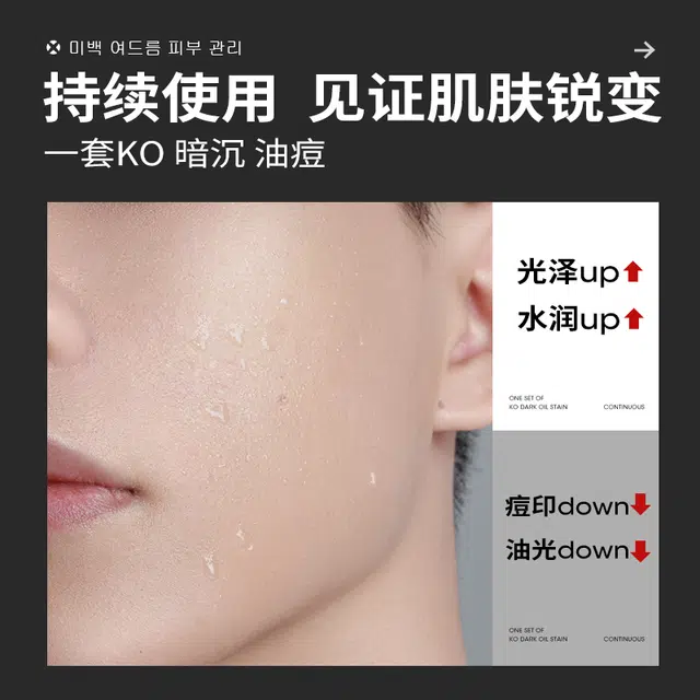 曼逖 男士水乳祛痘美白护发组合套装 淡化痘印清爽补水保湿防脱发 洗面奶+净痘调护水+保湿乳+洗发水+美白面膜