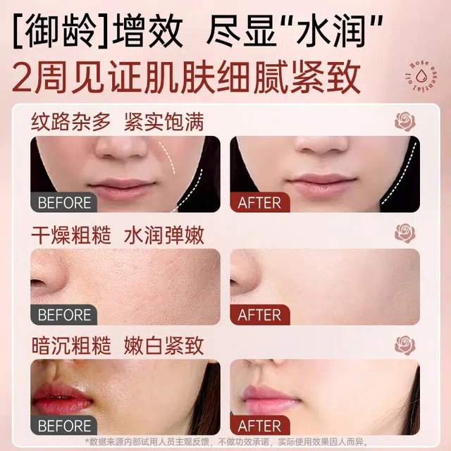 45ml90ml