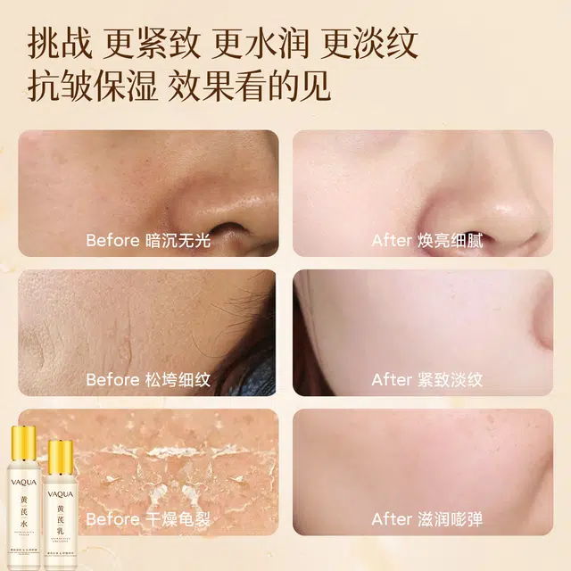 活泉 黄芪抗皱舒缓护肤套装 保湿补水 紧致淡纹提亮祛黄嫩肤收缩毛孔油皮清爽敏肌适用水乳洗面奶精华面膜面霜眼霜