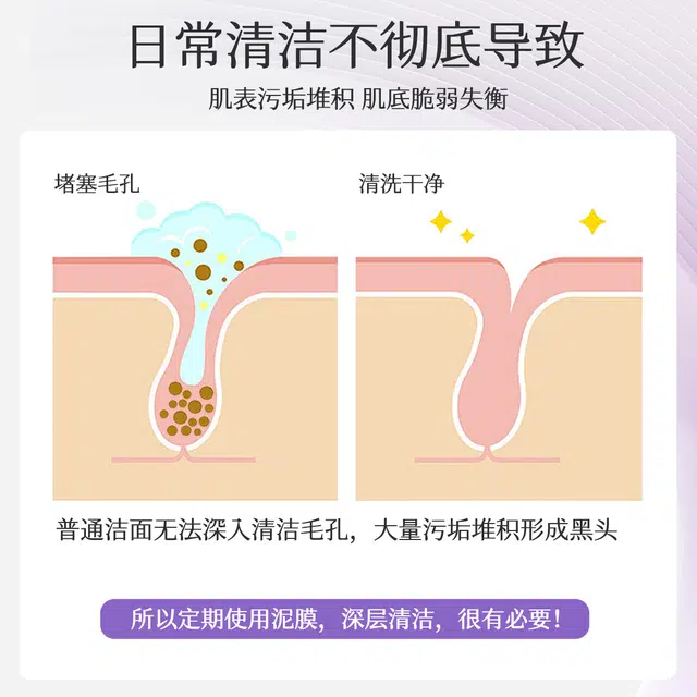 活泉紫苏净颜清洁控油舒缓白泥膜 保湿去角质去黑头收缩毛孔祛痘祛粉刺 去闭口改善肌肤深层洁净久敷不拔干顺滑涂抹面膜