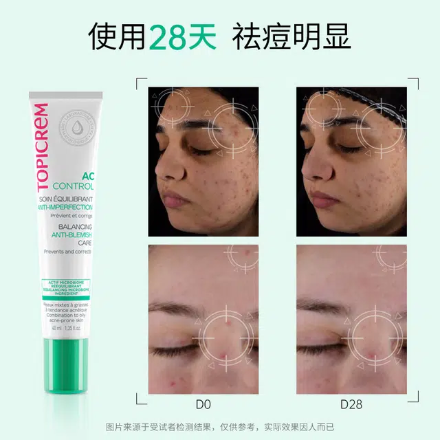 40ml