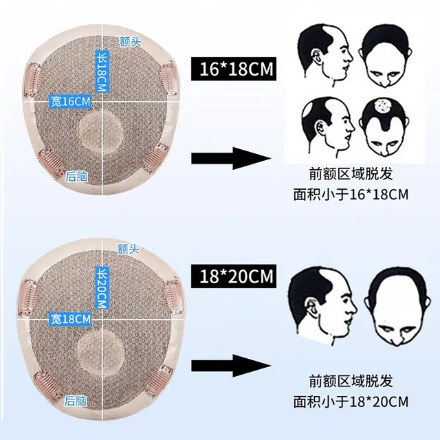 晚晚风 秃顶男士假发片 真发隐形头顶补发自然轻薄织发 自然黑