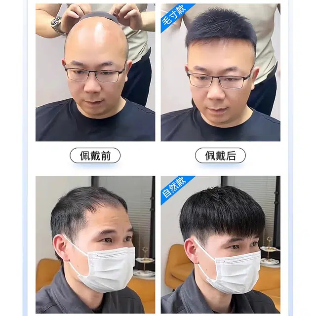 晚晚风 秃顶男士假发片 真发隐形头顶补发自然轻薄织发 自然黑