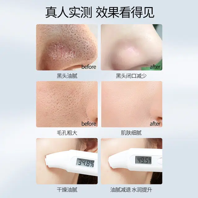 HKH 100g