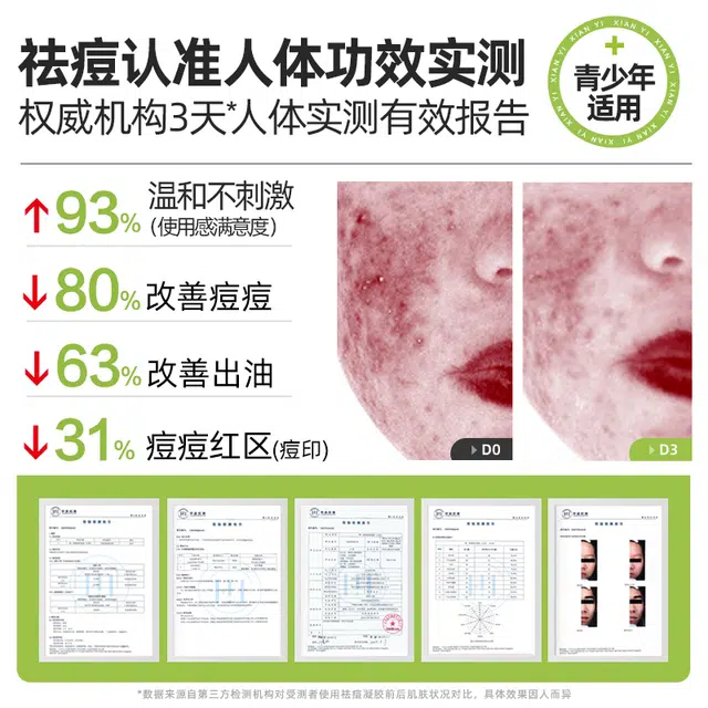 鲜一 清痘护肤套装 祛痘舒缓提亮淡痘印清爽修护补水控油清洁收缩毛孔祛粉刺 五件套