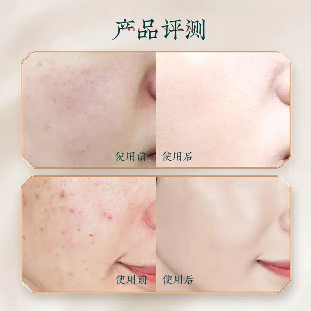 宫佩 花辰玉黛灵芝酵母水乳弹润舒缓肌底护肤套装 淡纹提亮紧致保湿滋润修护补水紧致毛孔淡化细纹