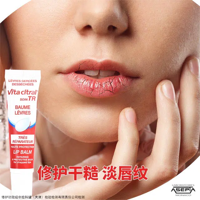 15ml