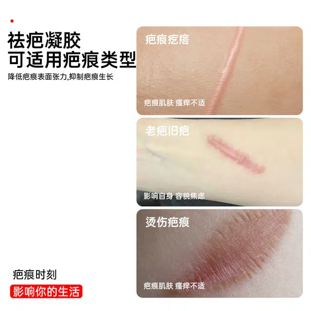 15g