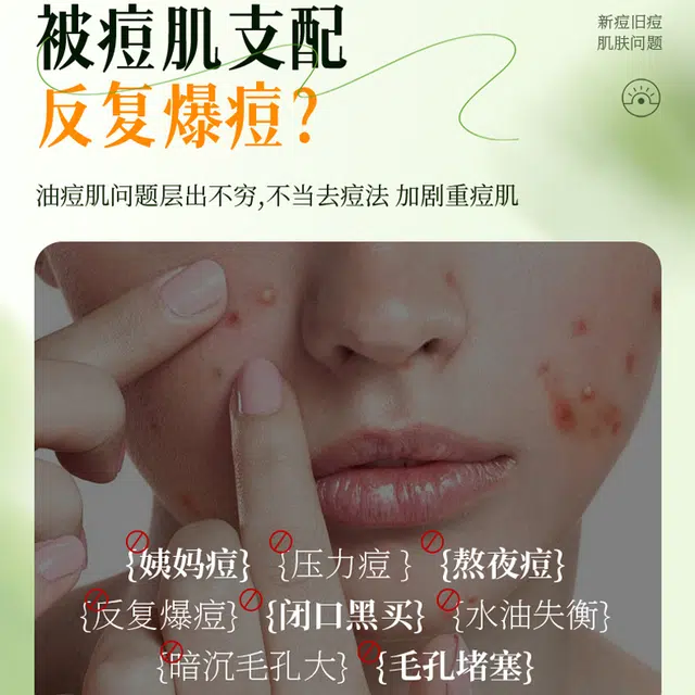 界面 水杨酸积雪草护肤套装 去黑头清洁