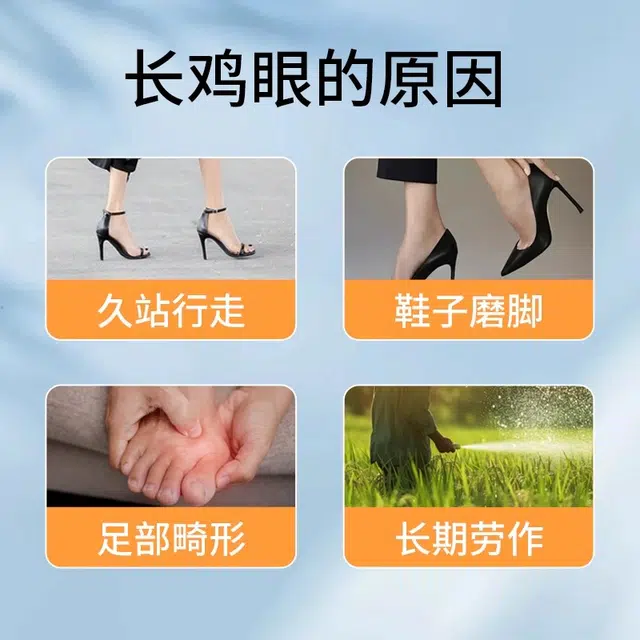界面 手脚足底瘊子疣跖疣肉刺鸡眼药膏贴去局部降温去除鸡眼贴温和