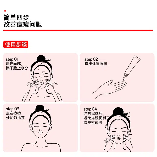 界面 去粉刺黑头壬二酸护肤套装 祛痘