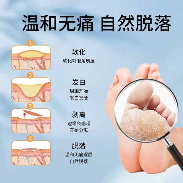 界面 手脚足底瘊子疣跖疣肉刺鸡眼药膏贴去局部降温去除鸡眼贴温和