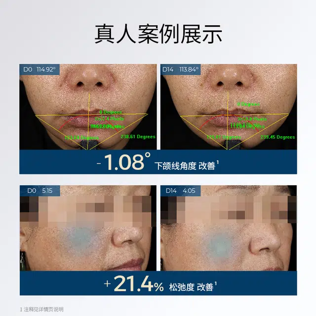 人源活力 重组胶原蛋白冻干面膜 保湿舒缓紧致修护 多种肤质