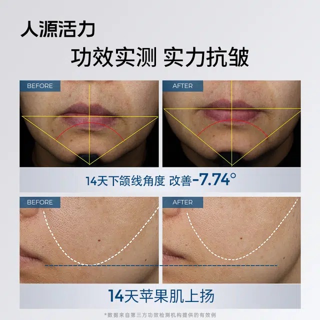 人源活力胶原冻干球精华 舒缓紧致保湿修护抗皱