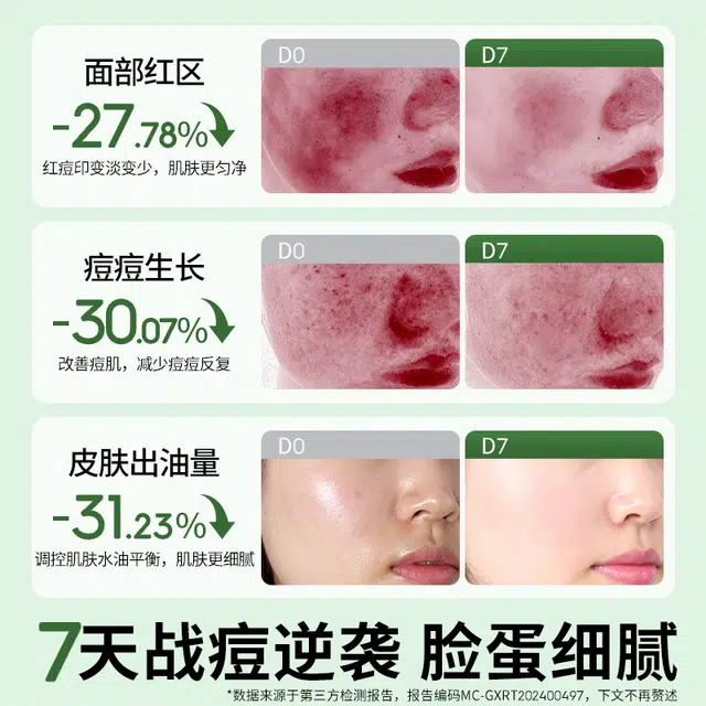 (25ml+2ml)*5