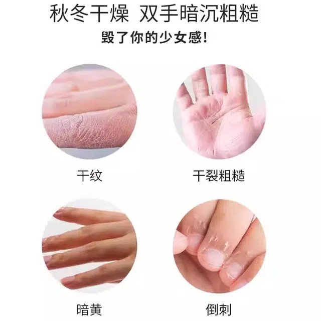 VHE 36ml*5 + 400g