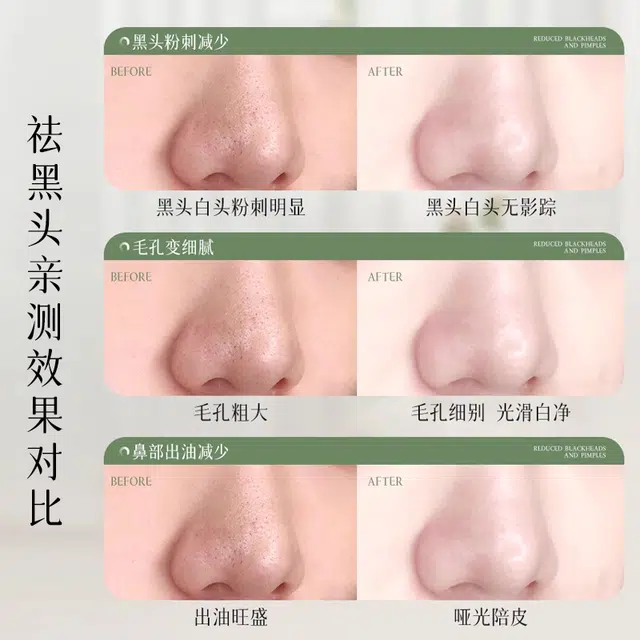 5ml*5