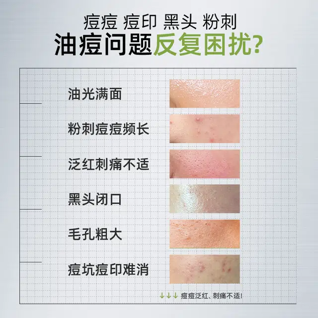 丽素丽速 超分子水杨酸祛痘控油面膜 舒缓维稳淡痘印补水去角质去黑头祛粉刺