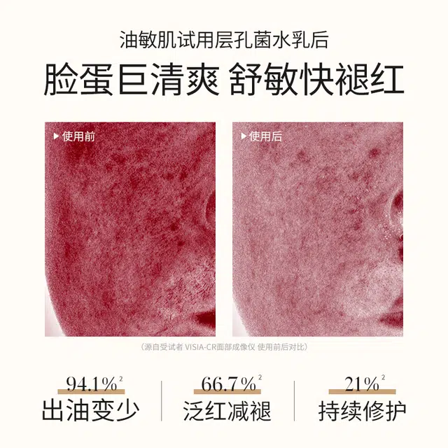 溪木源 【王源专属周边】 层孔菌水乳洗面奶套装敏感肌混油皮  控油舒缓补水